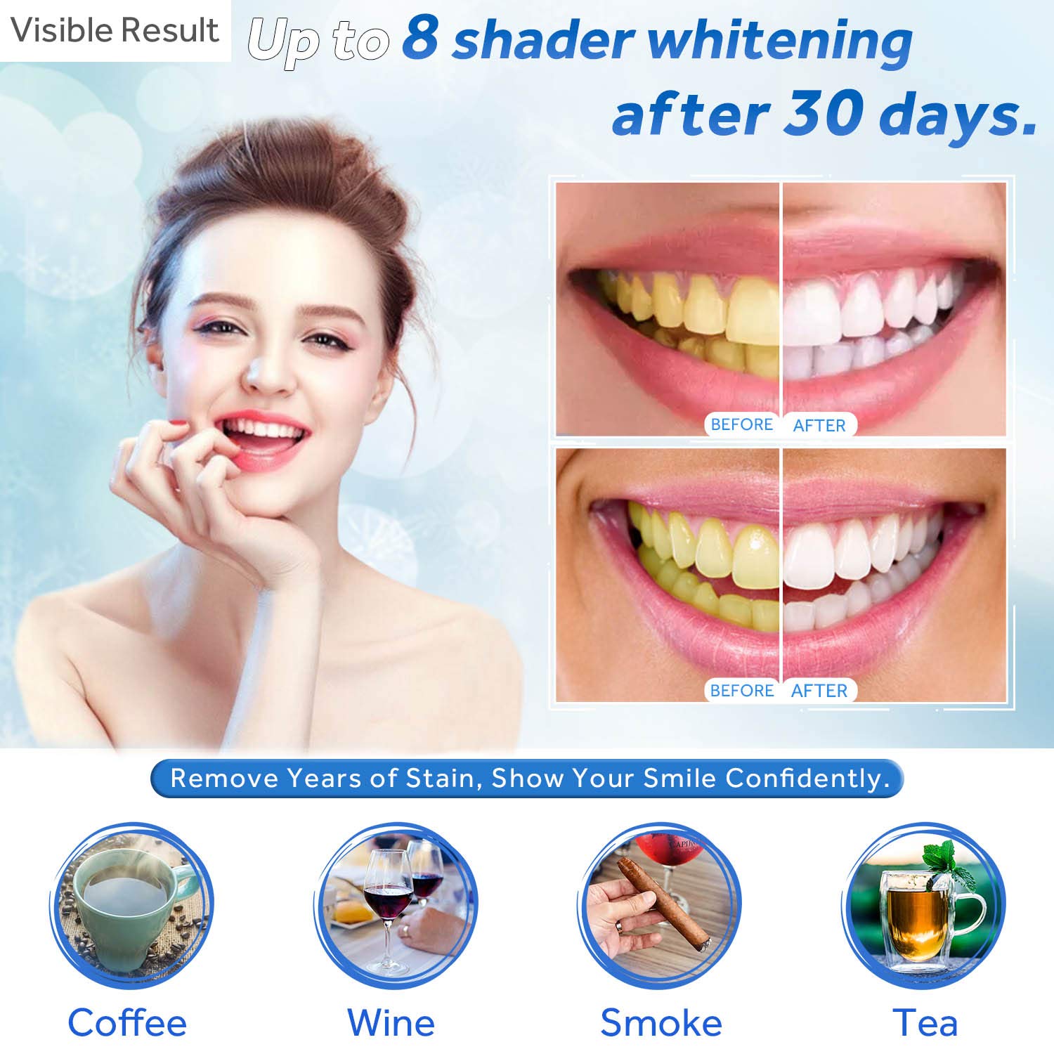 Teeth Whitening Gel Refill Syr - đánh giá và giá Teeth Whitening Doctor