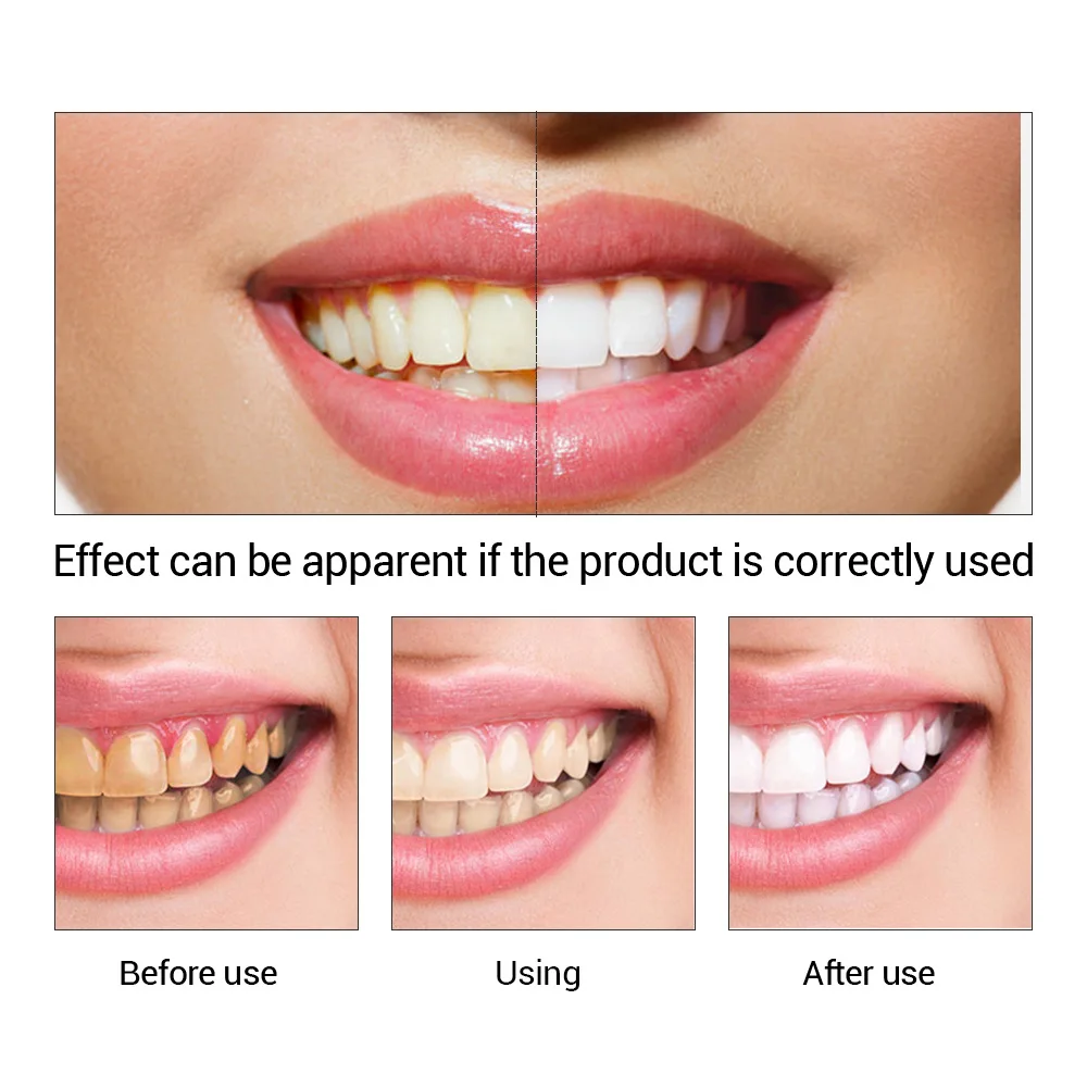 FTEENPLY Làm Trắng Răng Tinh C - đánh giá và giá Teeth Whitening Vape