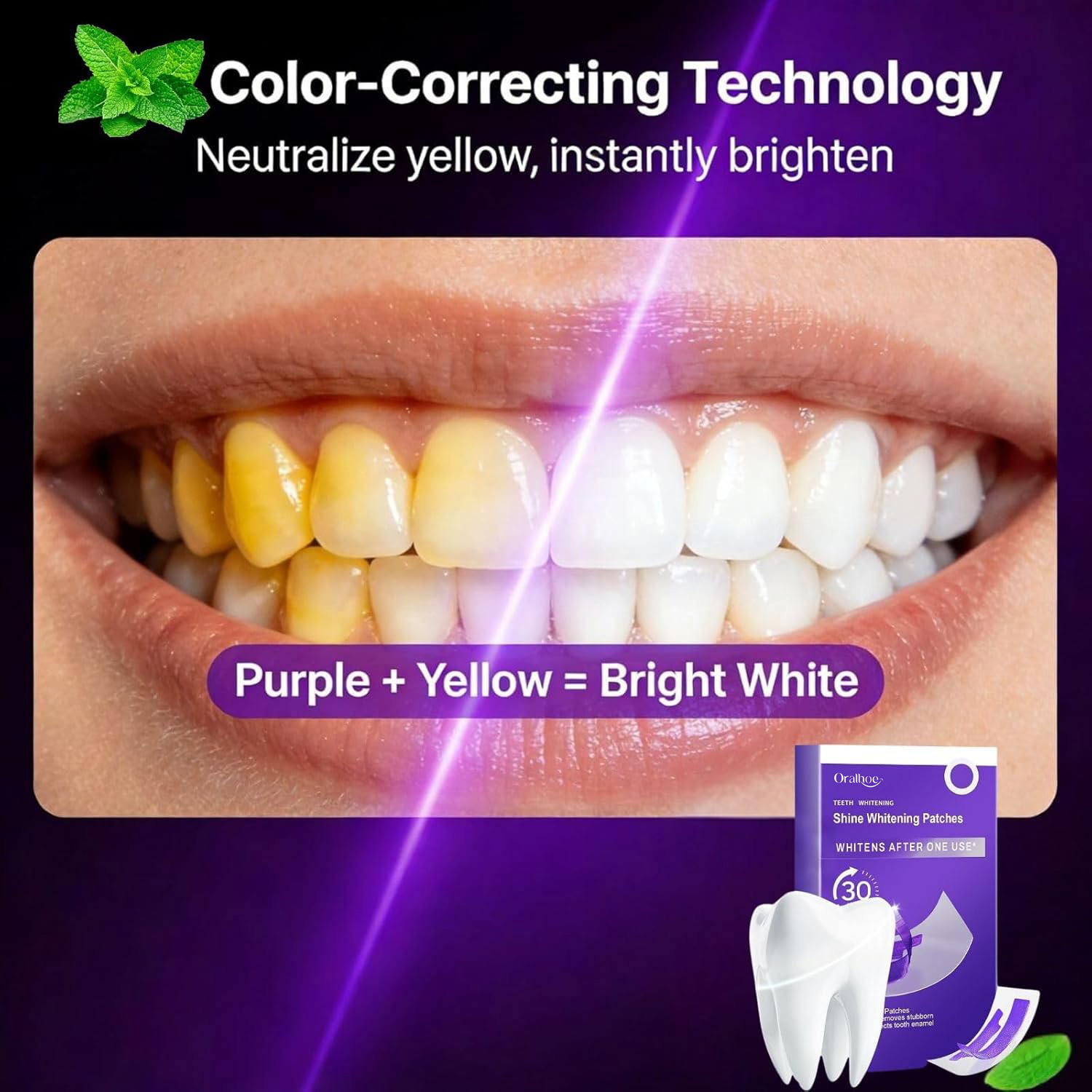 Purple Teeth Whitening Combo K - đánh giá và giá Teeth Whitening Home Kit