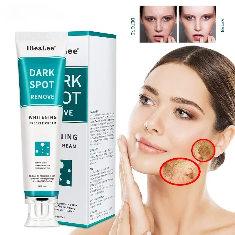 Whitening Freckle Cream Remove - đánh giá và giá Charcoal Whitening Paste