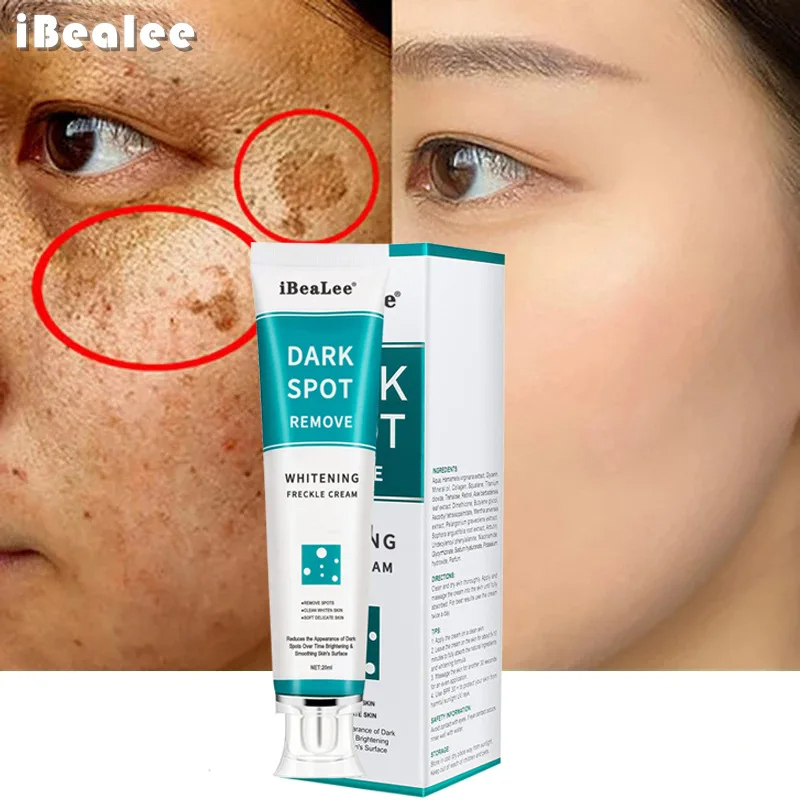 Whitening Freckle Cream Remove - đánh giá và giá Charcoal Whitening Paste