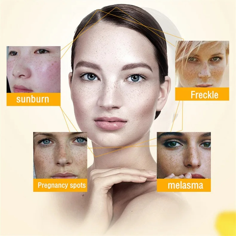 Whitening Freckle Cream Remove - đánh giá và giá Charcoal Whitening Paste