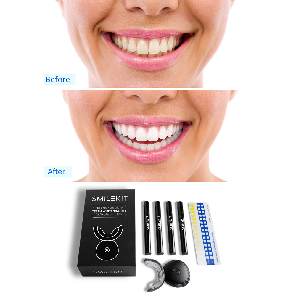 Điện Mới Làm Trắng Răng LED Sử - đánh giá và giá Teeth Whitening Home Kit