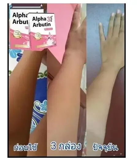 Alpha Arbutin 3 Plus Powder Mi - đánh giá và giá Charcoal Whitening Paste